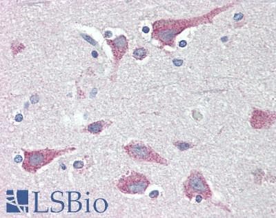 IHC-plus™ FKBP38 / FKBP8 Antibody