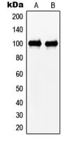 N4BP1 Antibody (Internal)
