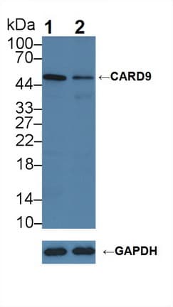 Polyclonal Rabbit anti-Human CARD9 Antibody (aa26-283, WB)