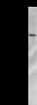 ACIN1 / Acinus Antibody (clone 2005C3a)