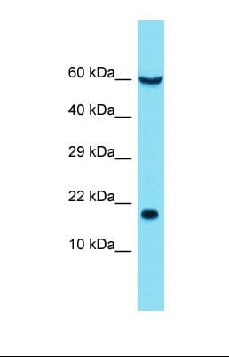 EIF5A Antibody (aa63-112)