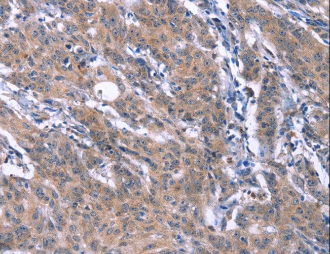 Polyclonal Rabbit anti-Human ESPL1 / Separase Antibody (IHC)