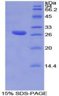 Mouse TOR1AIP2 Protein (Recombinant His-T7)