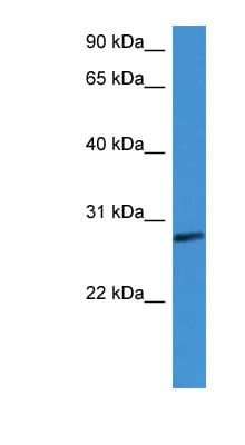 CFD / Factor D / Adipsin Antibody (aa160-209)