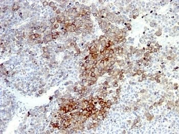 NGFR / CD271 / TNR16 Antibody (clone NGFR5 + NTR/912, Ready-to-Use)