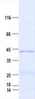 Human H2AFY / MACROH2A1 Protein (Recombinant His, N-Terminal)