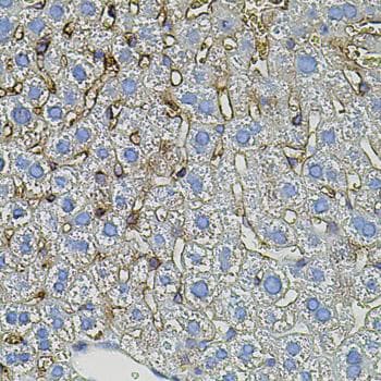 TGFA / TGF Alpha Antibody