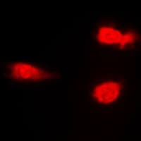 JNK1+2+3 Antibody (phospho-Thr183)