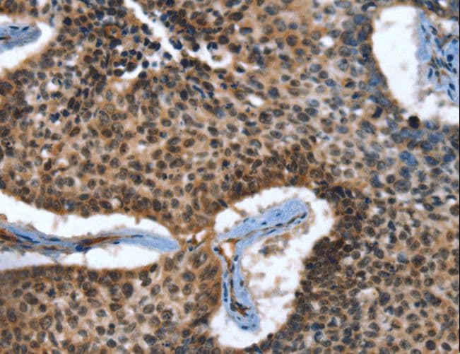 CACNB2 Antibody