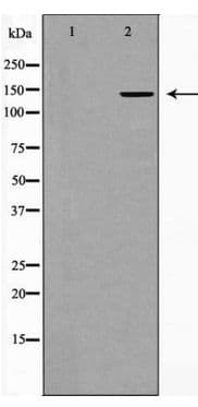 Polyclonal Rabbit anti-Human Collagen II Antibody (IHC, IF, WB)