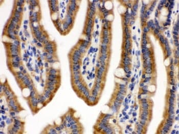 Polyclonal Rabbit anti-Human CDCP1 Antibody (IHC, WB)