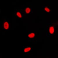 Polyclonal Rabbit anti-Human RXRG Antibody (Internal, IHC, IF, WB)