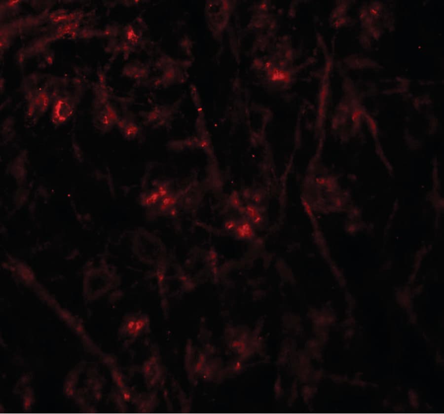 IHC-plus™ TMEM106A Antibody