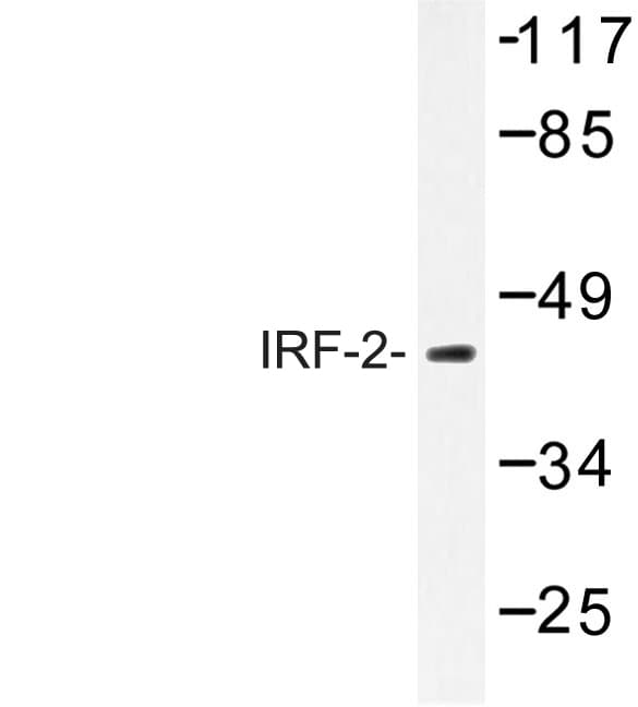 IRF2 Antibody (Lys129)