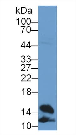 FABP4 / AP2 Antibody (aa2-132)