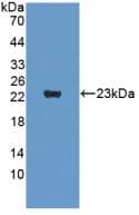 SVIL / Supervillin Antibody (aa1385-1525)