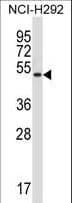 MOK / RAGE Antibody (aa76-104)