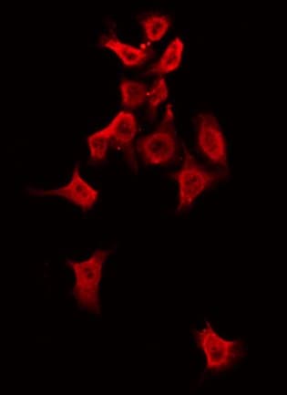 ALPK1 Antibody