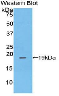 PHLDA2 / TSSC3 Antibody (aa9-140)