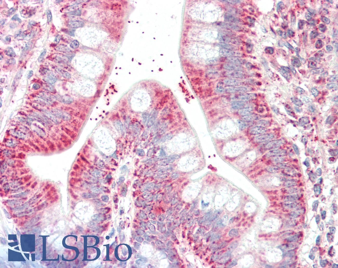 IHC-plus™ CSNK1A1 / CK1 Alpha Antibody