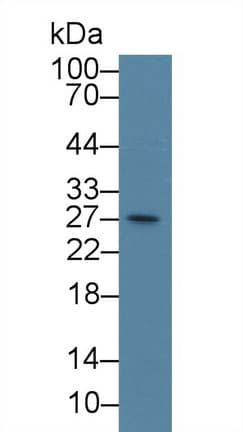 CENPH / CENP-H Antibody (aa1-247)
