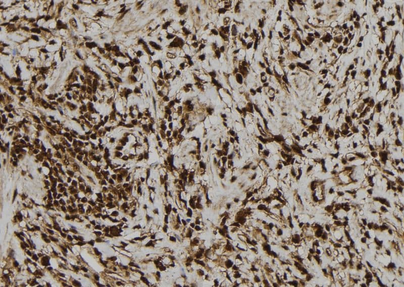 PVALB / Parvalbumin Antibody
