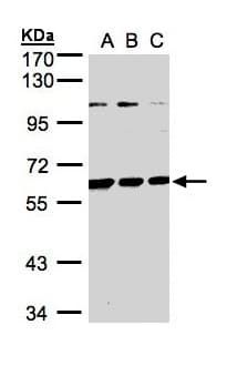 Polyclonal Rabbit anti-Human BIVM Antibody (aa439-503, IHC, WB)