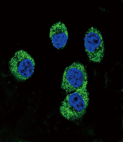 MOK / RAGE Antibody (aa206-234)