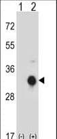 KLK10 / Kallikrein 10 Antibody (aa22-51)