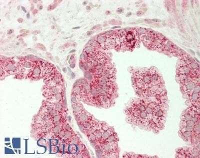 IHC-plus™ HIF1A / HIF1 Alpha Antibody (aa 579-826)