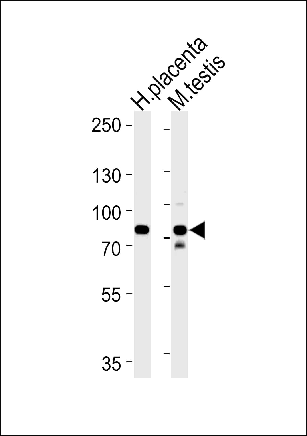 SEMA7A / Semaphorin 7A Antibody (aa178-202)
