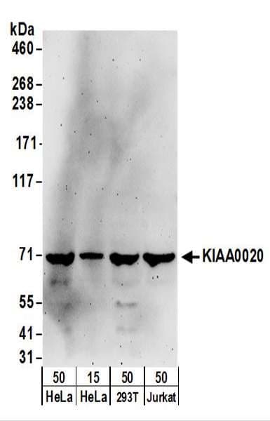 Polyclonal Rabbit anti-Human KIAA0020 / PEN Antibody (aa1-50, WB)