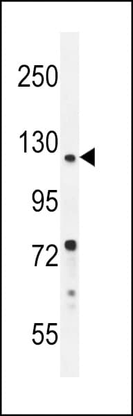 DDX11 / CHLR1 Antibody (aa819-847)