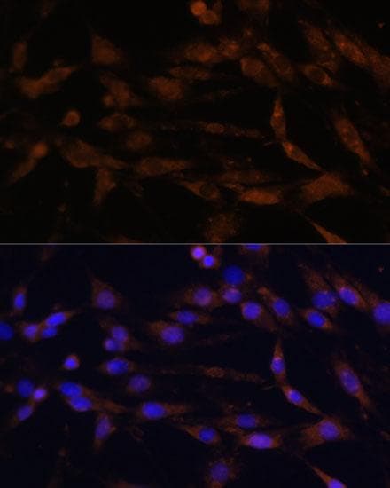 CD44 Antibody