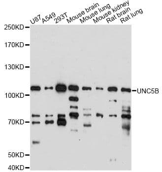 UNC5H2 / UNC5B Antibody