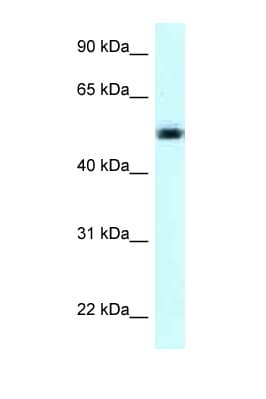 Polyclonal Rabbit anti-Human NAPRT Antibody (aa401-450, WB)