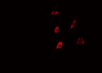 RAB35 Antibody