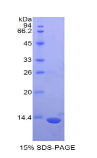 Mouse S100 Protein (Recombinant His)
