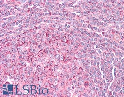 IHC-plus™ Polyclonal Rabbit anti-Human UCP2 Antibody (IHC)