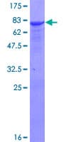 Human ALDH9A1 Protein (Recombinant GST)