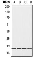 EIF5A Antibody (Internal)