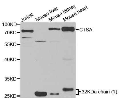 CTSA / Cathepsin A Antibody
