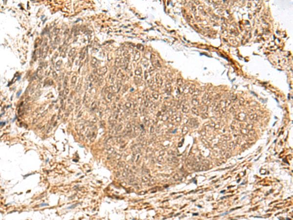 GEMIN4 Antibody
