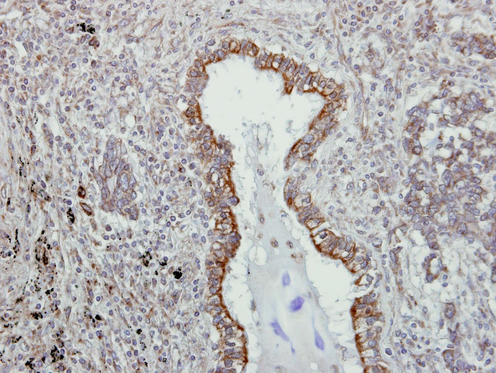 VAP33 / VAPA Antibody
