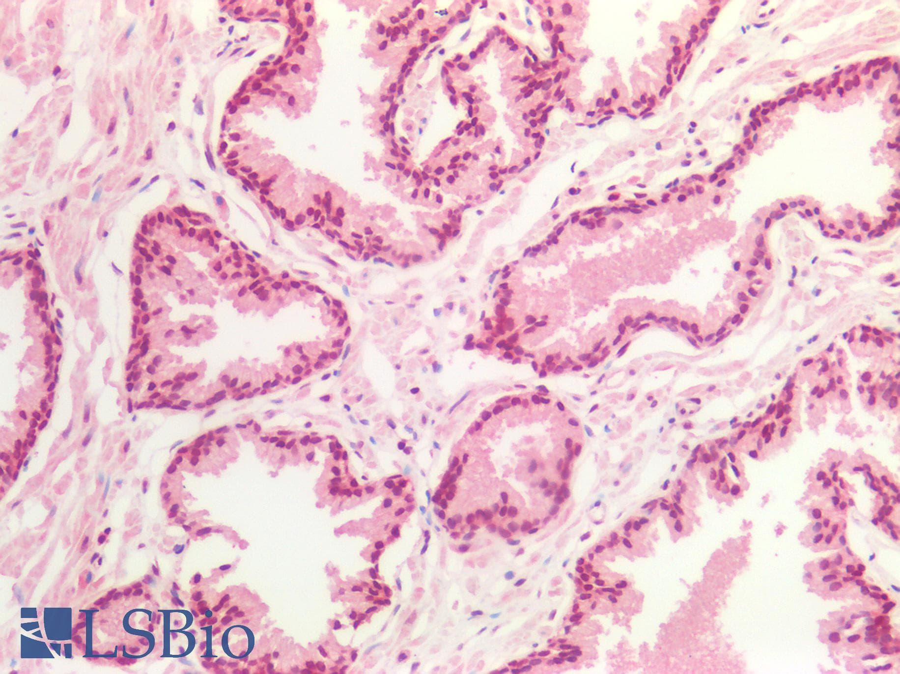 IHC-plus™ Polyclonal Rabbit anti-Human DNMT / DNMT1 Antibody (aa1603-1616, IHC)