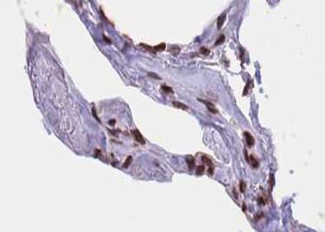 Polyclonal Rabbit anti-Human ELK1 Antibody (phospho-Ser389, IHC, IF, WB)