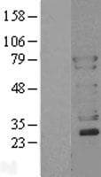 Human WASL / N-WASP Protein (Over-Expression Lysate Myc-DDK (Flag))