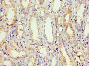 POSTN / Periostin Antibody (aa557-836)