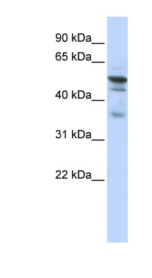 NMT1 Antibody (aa108-157)