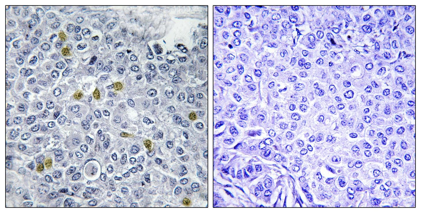 TOP2A / Topoisomerase II Alpha Antibody (phospho-Ser1106)